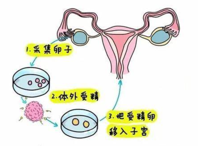 试管婴儿技术为什么要先促排卵？