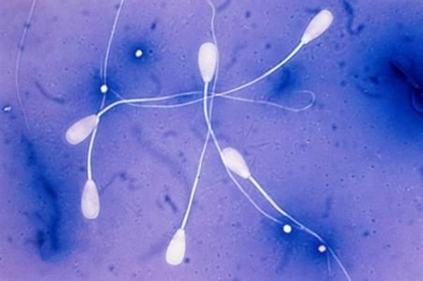 男人y精子少是怎么回事？