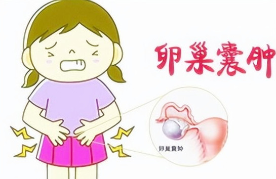 卵巢囊肿的症状有哪些